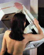 Sabato 5.3 in via Monti l’Unità mobile mammografica dell’Ispo